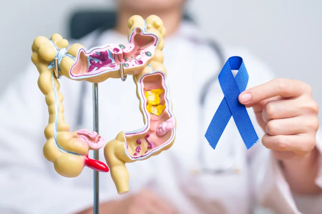 Diagnóstico y tratamiento del cáncer de colon y recto