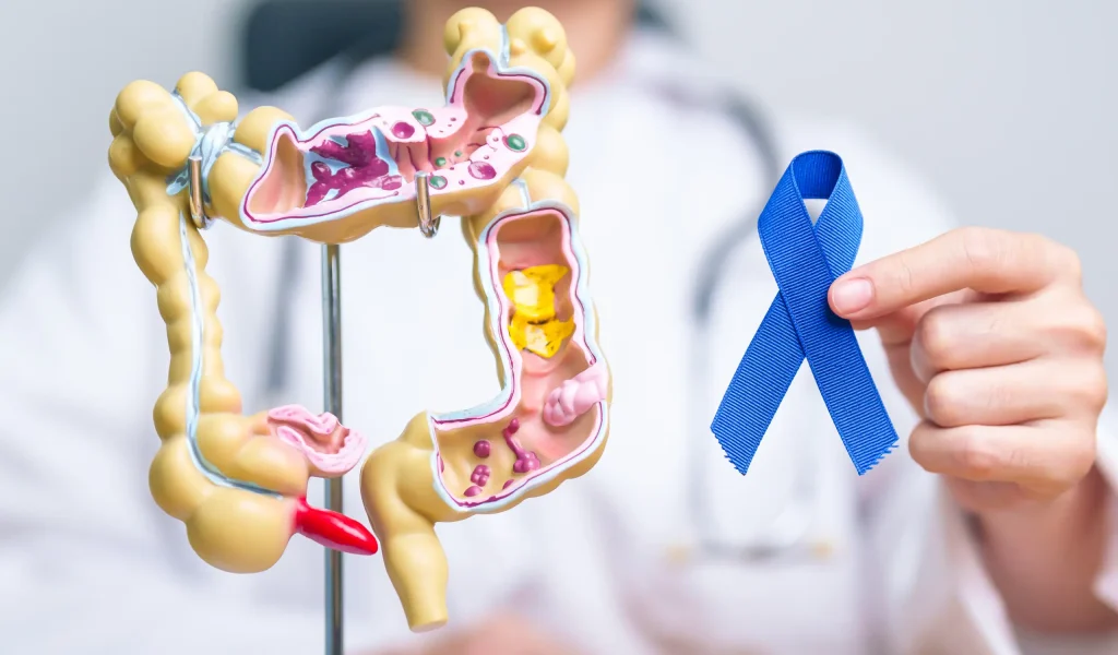 Diagnóstico y tratamiento del cáncer de colon y recto